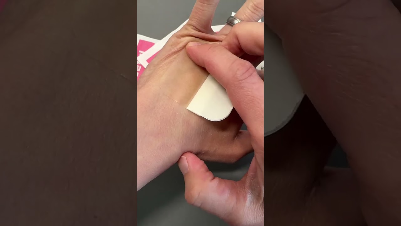 How to PUT ON and TAKE OFF Hydrocolloid Bandages! Niceful!