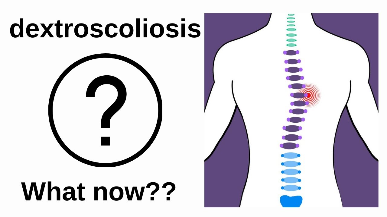 What is dextroscoliosis?