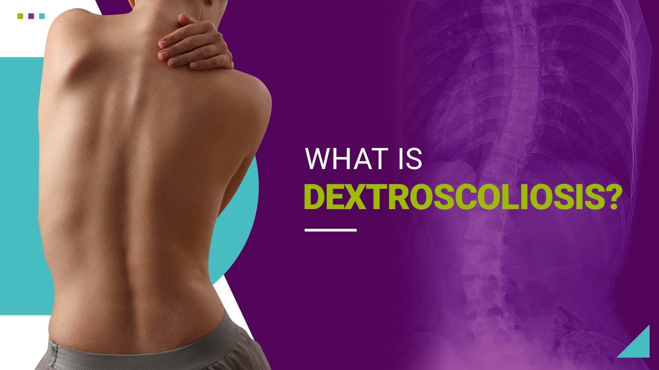 What is Dextroscoliosis?