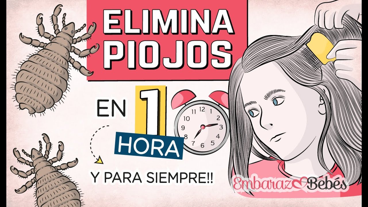 💇🏻‍♀️🔥 3 Remedios para ELIMINAR PIOJOS y Liendres en 1 HORA y para Siempre!!!