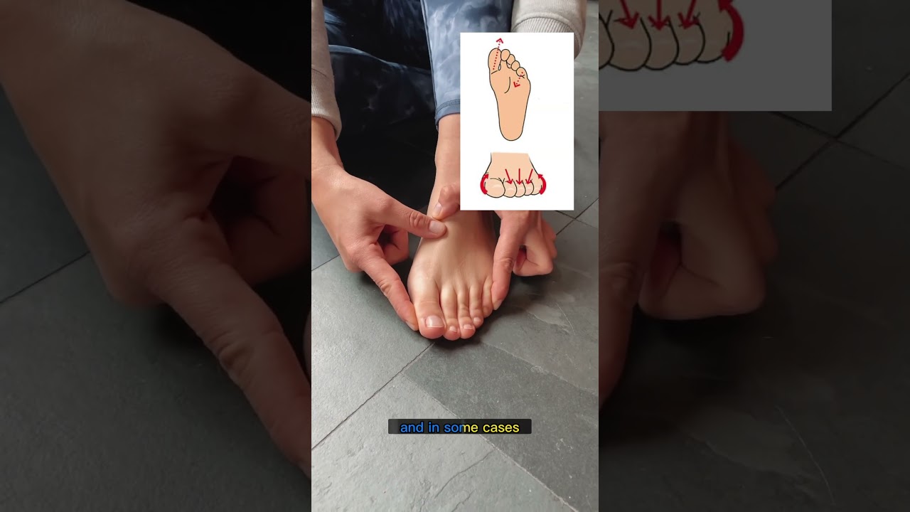 What do the toe spacers do? #mobility #flexibility #foothealth
