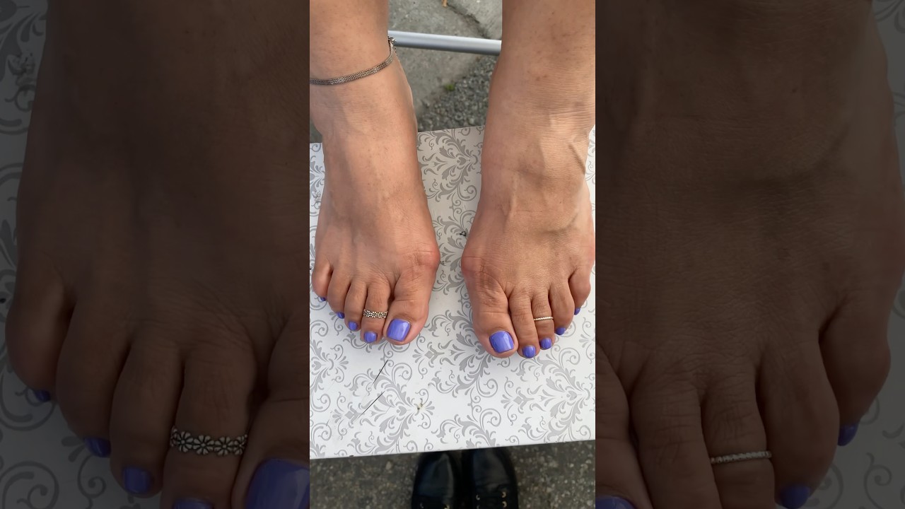 Feet Finder Toe Rings #fancyfeetco #feet #permanenttoering #toes #feet #feetcare